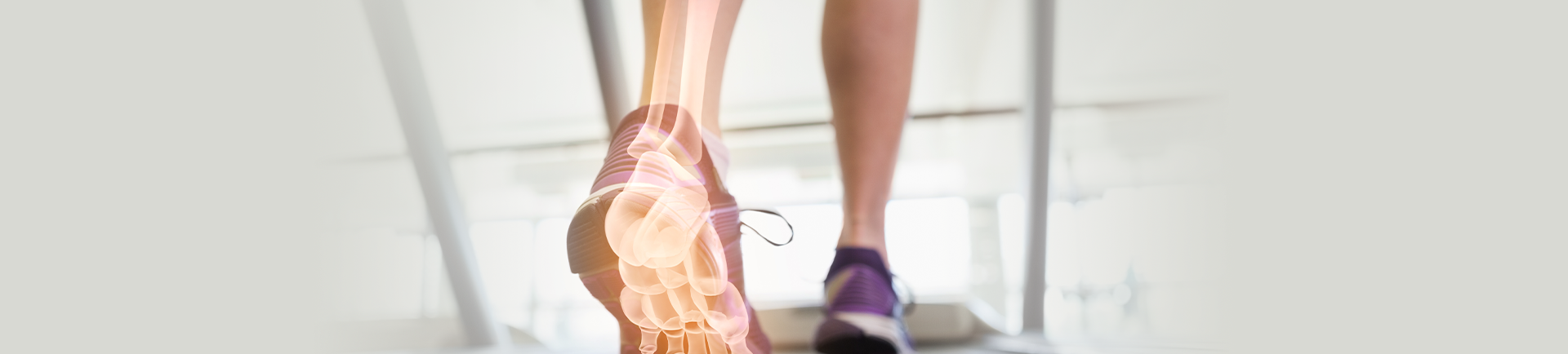 foot X-ray on treadmill