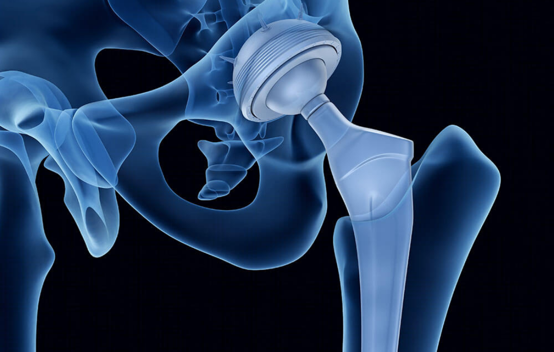 Hip Anatomy Video, Hip Orthopaedics Videos