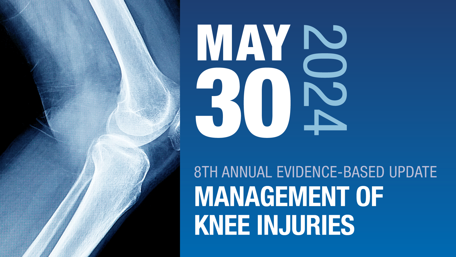 May Management of Knee Injuries